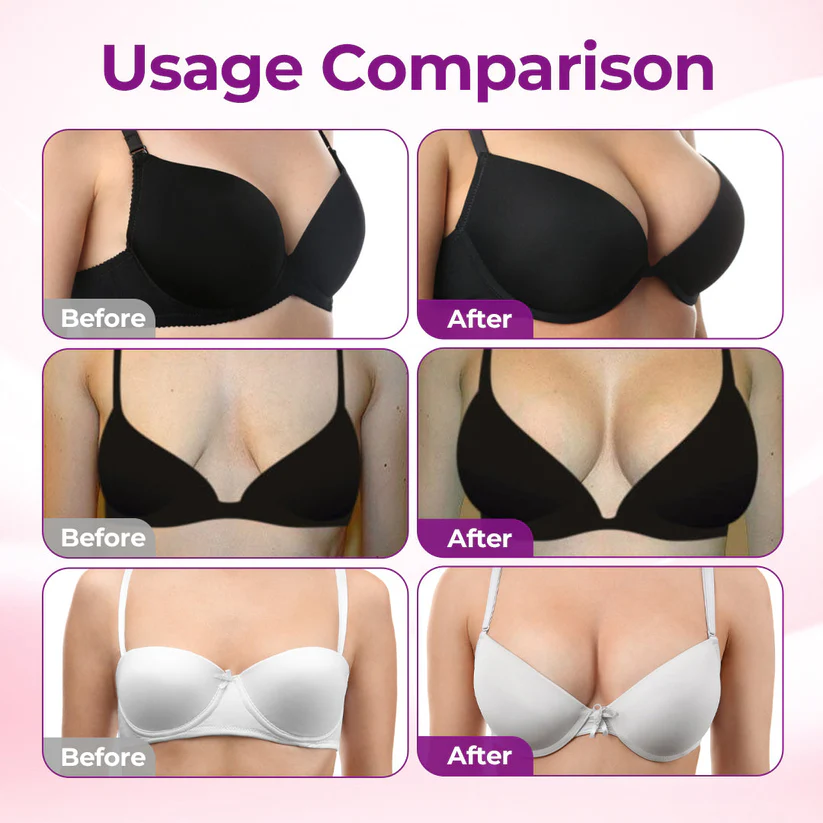 💥Ctmson® Targeted Breast Enhancement Advanced Nano Microneedle Patch
